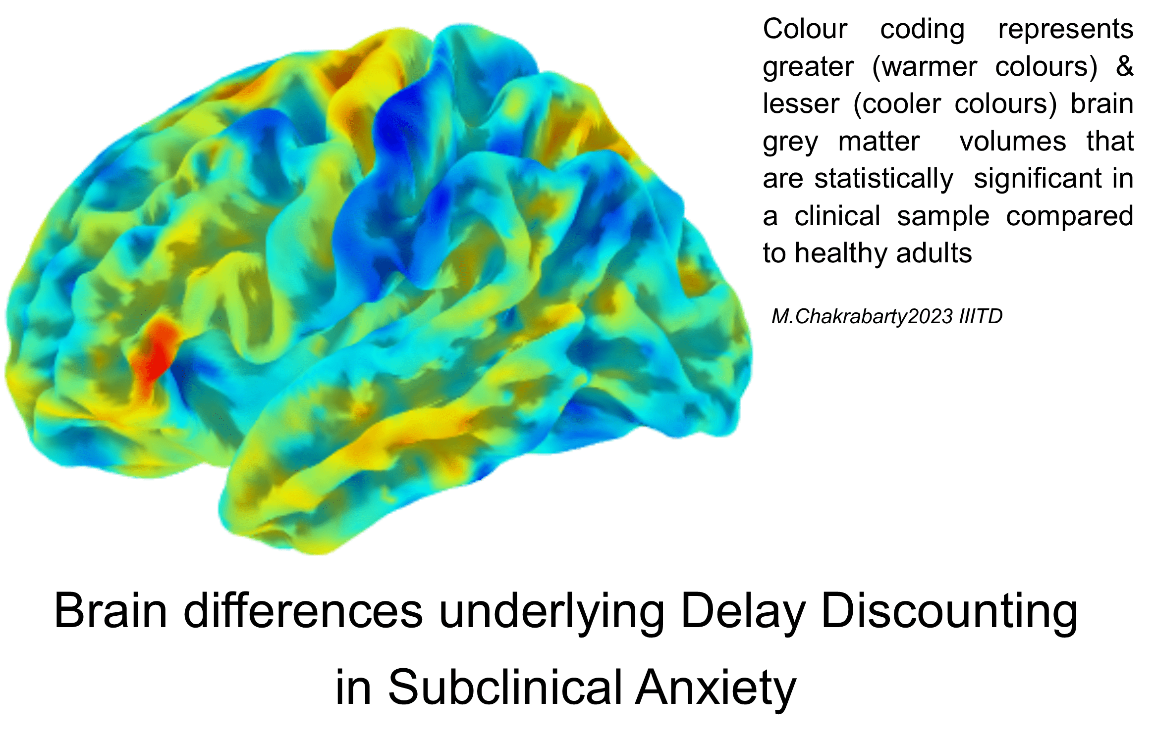 Brain Differences